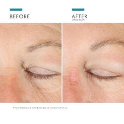 A.G.E. Advanced Eye mot morka ringar