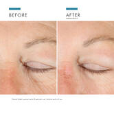 A.G.E. Advanced Eye mot morka ringar